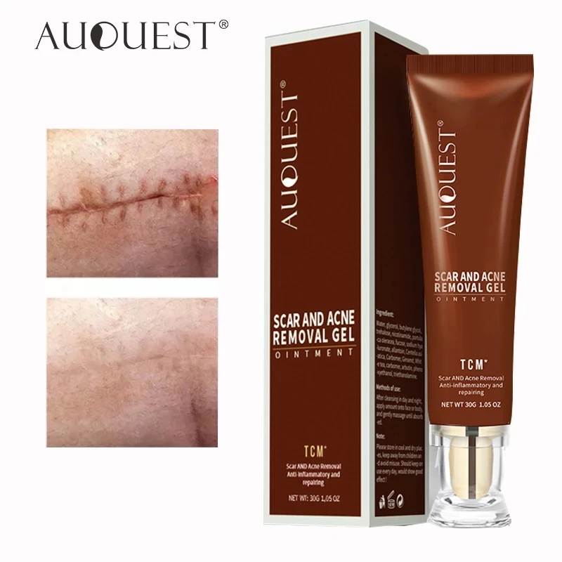 

AuQuest Scar Remover Gel Anti Aging Lotion Acne Scar Removal for Old Scars on Body Scar Treatment Skin Care for Men Women 30g