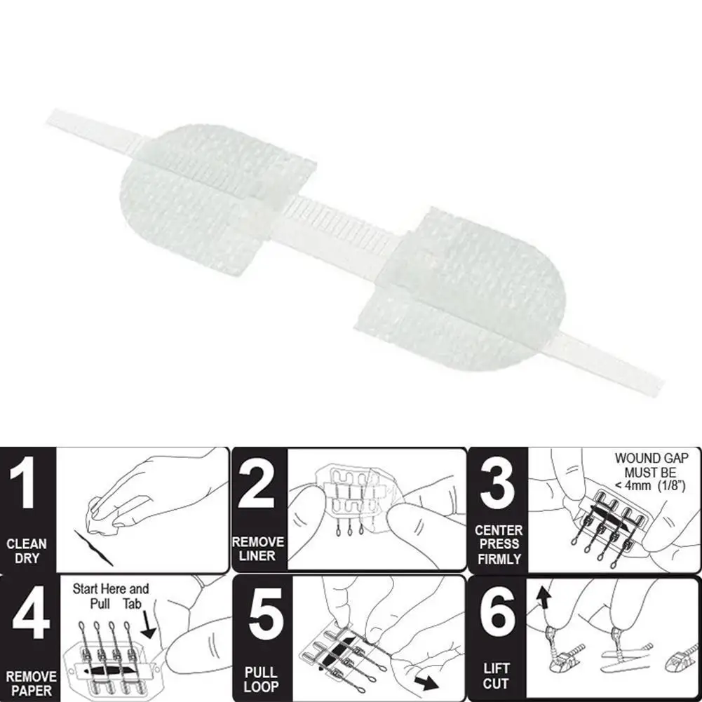 

Zipper Tie Wound Closure Patch Hemostatic Patch Wound Fast Suture Zipper Band-Aid Outdoor Portable white 70 * 22mm / 45 * 10mm