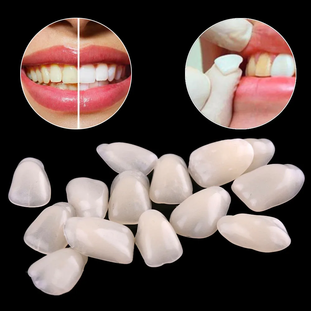 

70PCS Dental Ultra-Thin Whitening Veneers Resin Porcelain Materials Temporary Teeth Upper Anterior Whitening Dental Film（No glue