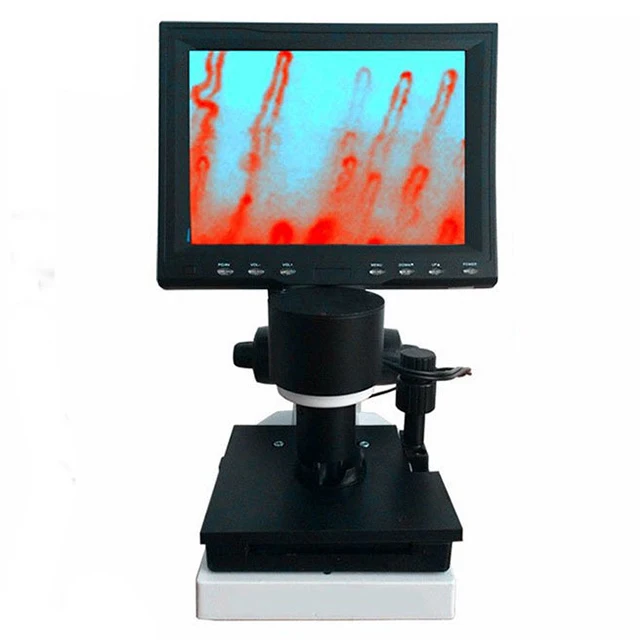 

Nail Checking Fold Capillary Microcirculation Microscope
