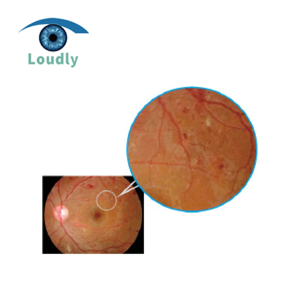 Китай лучшее качество оптические инструменты Настольный fundus камера APS