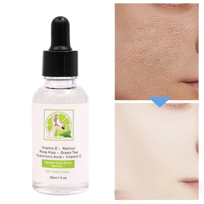Гиалуроновая Кислота Витамин С Сыворотка витамина для лица C увлажняющая
