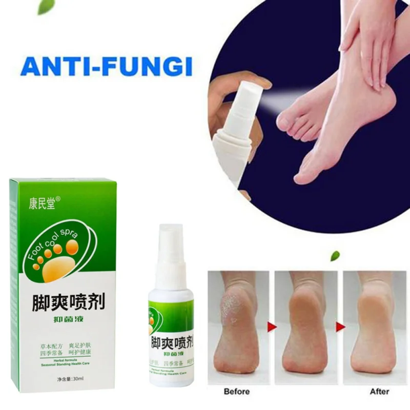 

30ml Feet Problem Remove Odor Sweat Plant Spray Feet Care