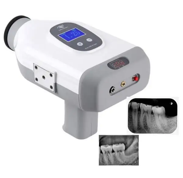 Стоматологический высокочастотный рентгеновский аппарат цифровой