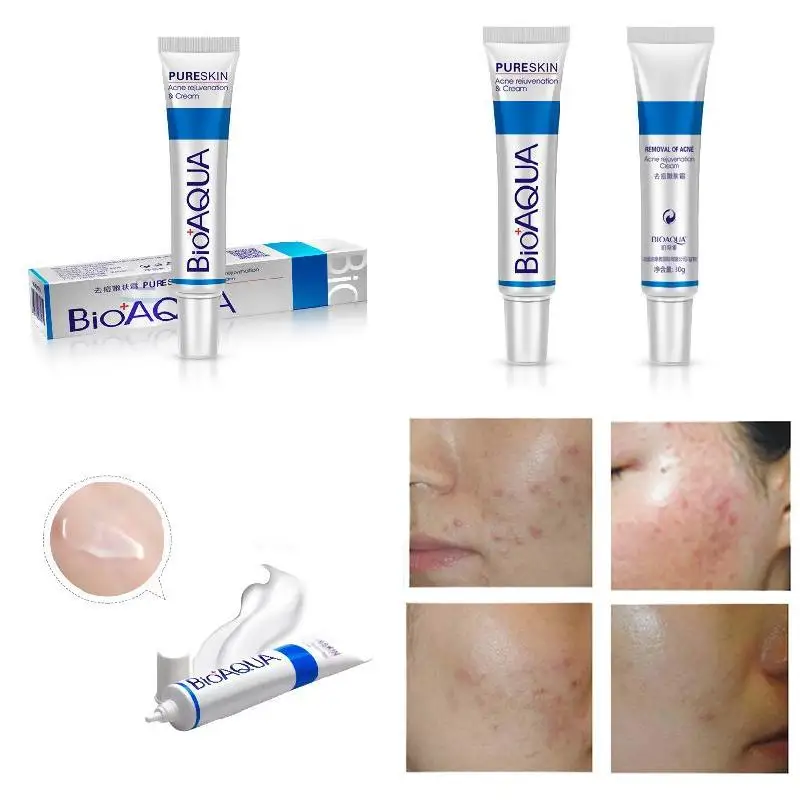 Крем Bioaqua 30 г для лечения акне удаленное лечение черных точек крем от контроль
