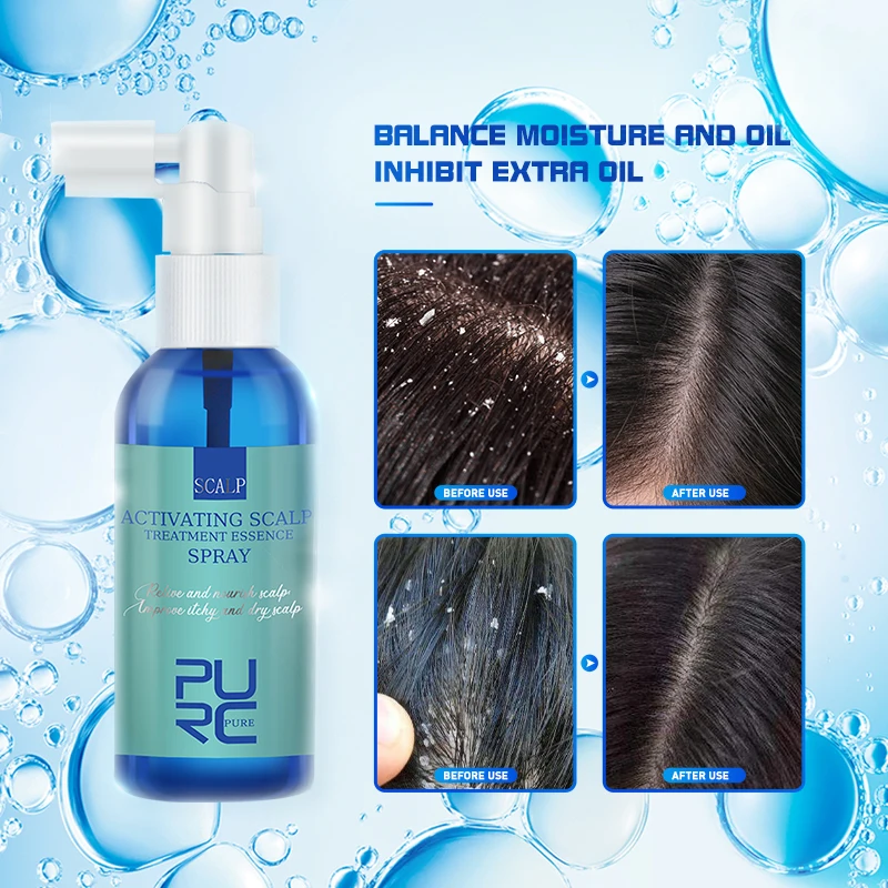 

PURC Hair Scalp Treatment Anti Dandruff Anti Itch Essence Spray Prevent Hair Loss Oil Control Hair Care Products for Women 60ml