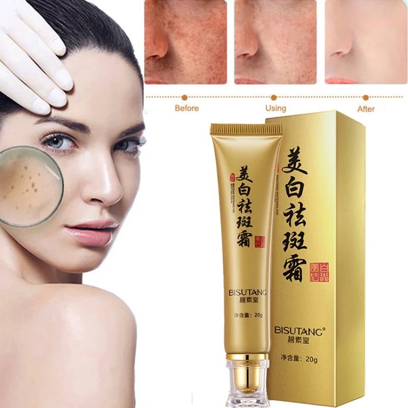 

1Pcs Effective Whitening Freckle Cream Remove Melasma Acne Spot Pigment Melanin Dark Spots Pigmentation Moisturizing Skin Care