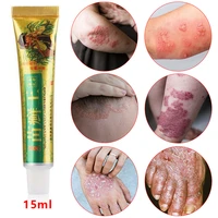 1pcs eczema pruritus psoriasis treatment herbal formula herbal medicine cream skin problems dermatitis