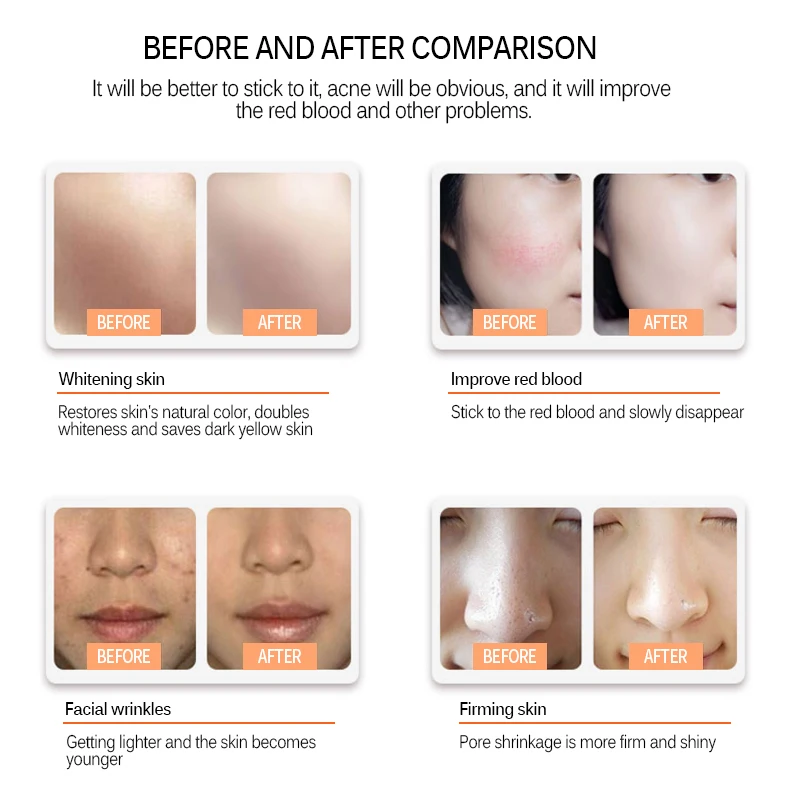 Ultima A1 Электрическая Micro Needling ручка с микроиглы мезотерапия авто микро иглы