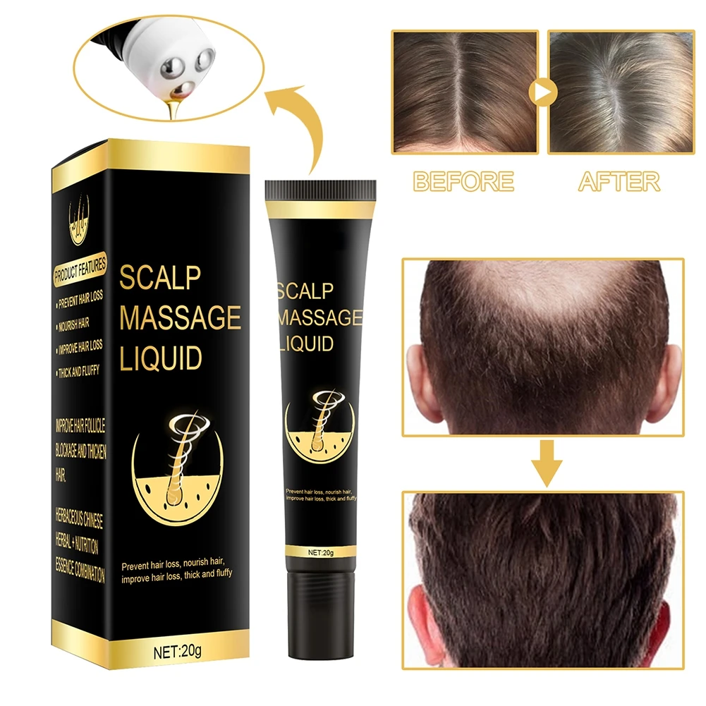 

Anti Hair Loss Scalp Massage Roller Hair Growth Oil Thickener Essence Treatments Fast Grow Hair Serum Y