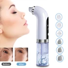 Вакуумный аппарат для удаления черных точек LURNOFY, глубокое очищение лица, вакуумные Пузырьковые поры, уход за кожей в акне, очистка лица и носа от черных точек