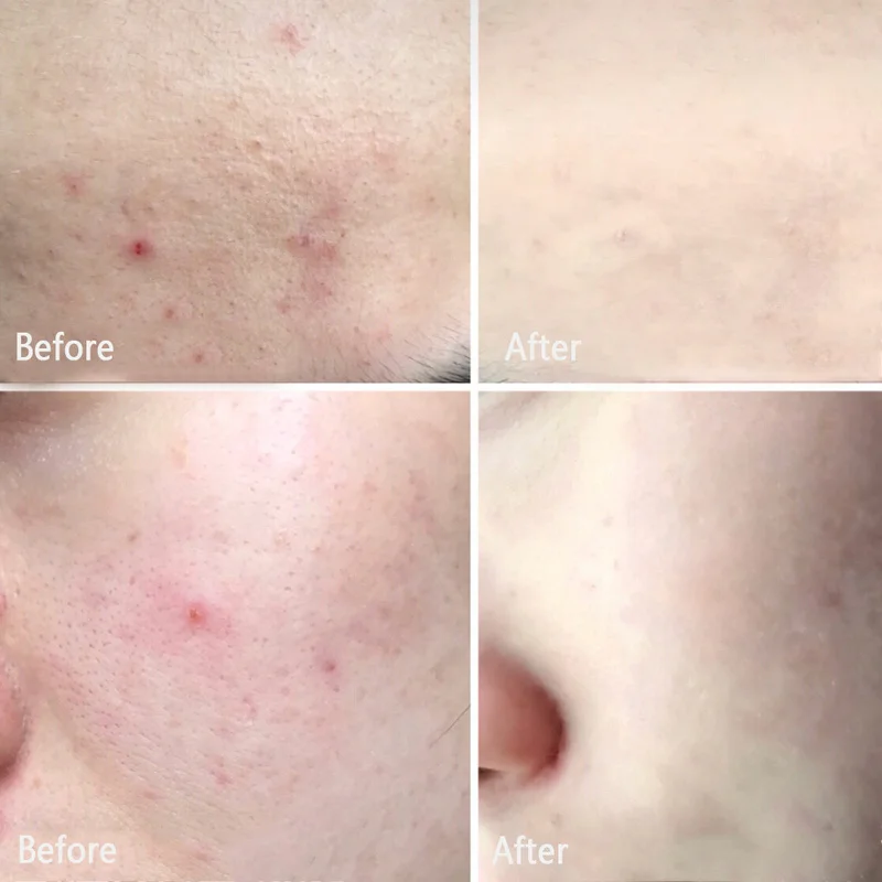 Жидкий консилер TSLM1 жидкий для макияжа глаз с полным покрытием темные круги