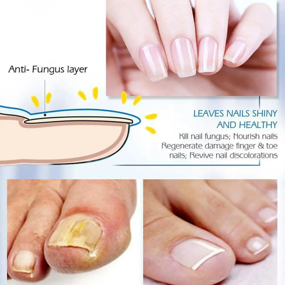 

10ML Nail Nutrition Oil Pen Nail Repair Liquid Essential Cuticle Nail Care Nail Care Remover Anti-fungal Growth D4Q3