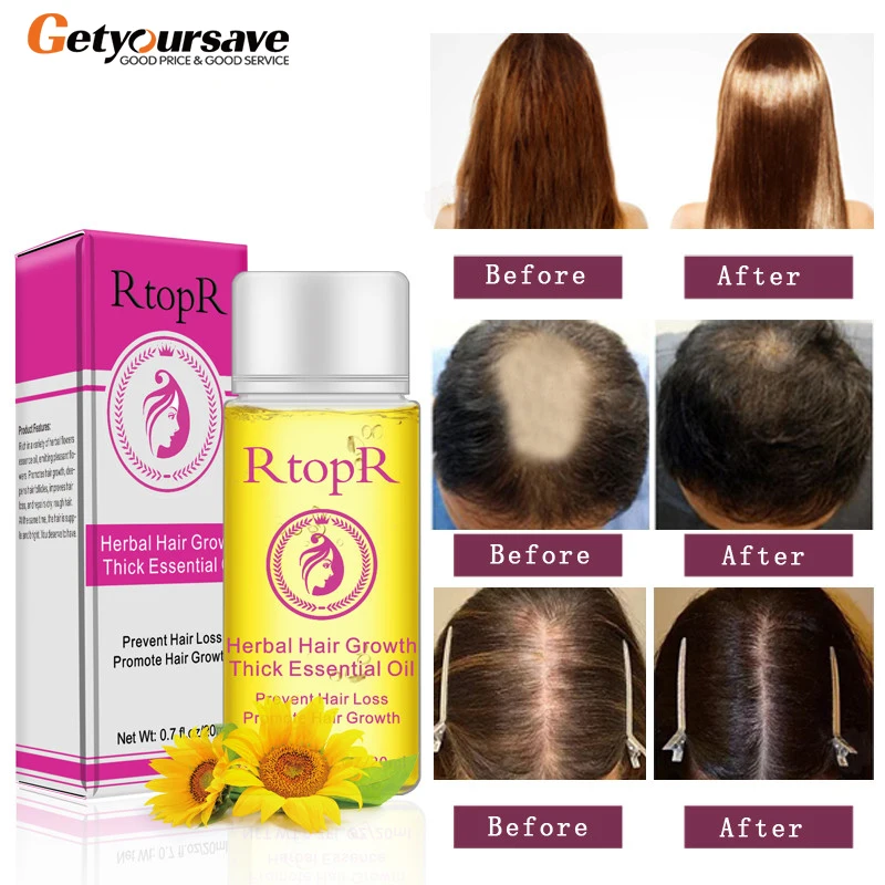 Травяная Жидкость против выпадения волос для лечения роста густых и быстрых 20 мл