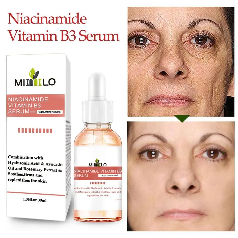 

30 мл Niacinamide для лица Витамин B3 сыворотка укрепляющая восстанавливающая кожа против морщин Антивозрастная осветляющая сыворотка для кожи ух...