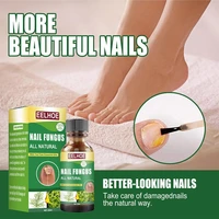 30ml nail fungus treatment antifungal nail solution ringworm clear healthy toenail growth care essence for onychomycosis