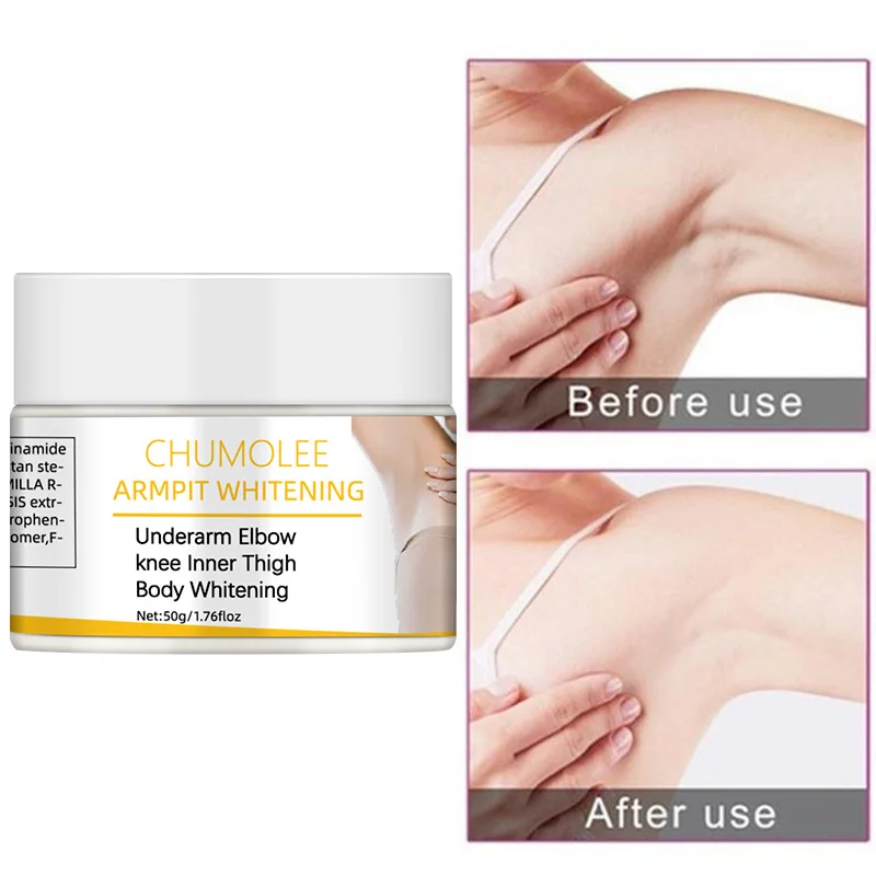 

CHUMOLEE Armpit Whitening Cream Body Whitening Underarm Knee Dark Spot Cream Skin Brighten Moisturizing Dark Skin Care Lotion