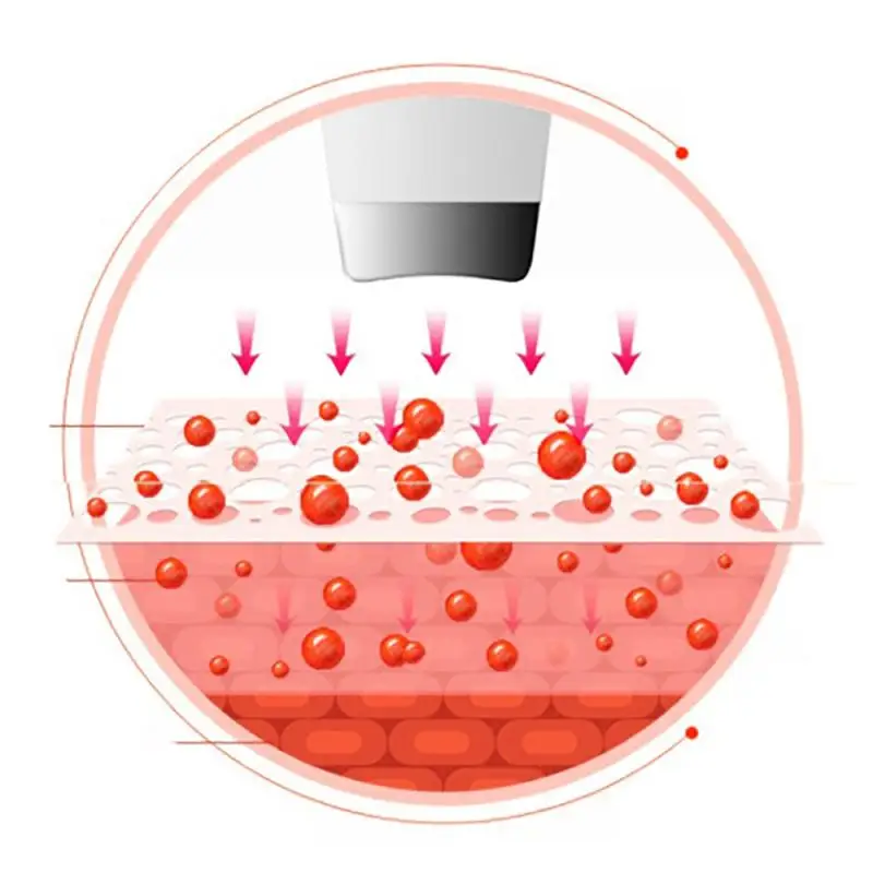 

Ultrasonic Skin Scrubber Peeling Shovel Facial Cleansing Skin Spatula Acne Blackhead Remover Skin Care Cleansing Instrument