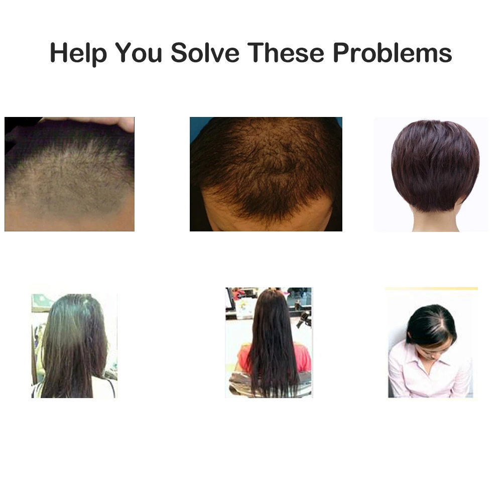 Жидкий Усилитель роста волос выпадение утолщение лечение формула сыворотка для