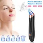 Пылесос для удаления черных точек на лице, от акне и пор