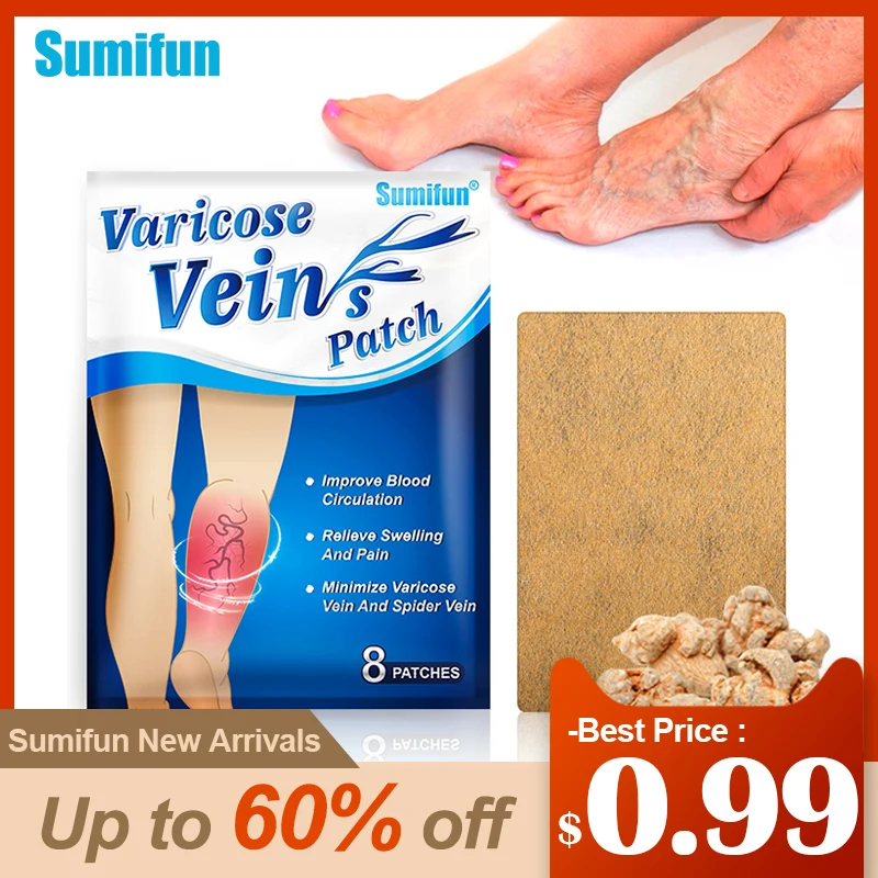 

8pcs Sumifun New Varicose Veins Plaster Vasculitis Phlebitis Spider Leg Chinese Medical Patch Angiitis Removal Patch Health Care