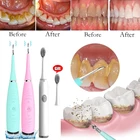 Новинка, ультразвуковой зубной скалер, зубной скалер, электрический прибор для чистки зубов, зубная нить, стоматологический прибор для чистки зубов