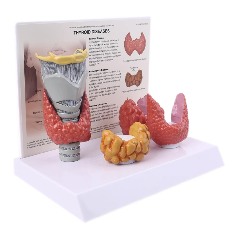 

1 Set Life-Size Human Anatomical Thyroid Gland Model Pathology Anatomy Digestive System Display Vivid Design Study Teaching Tool