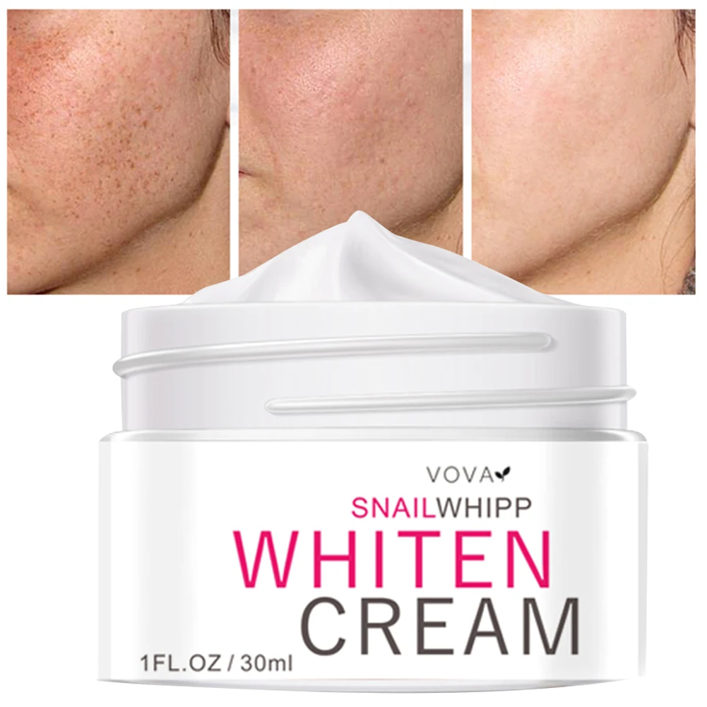 

VOVA Dark Spots Remover for Face Dark Spots Corrector Cream Face Cream for Age Spot Skin Whitening Cream for Men Women