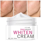 VOVA Dark средство для удаления пятен для лица, темные пятна, мерцающий крем для лица для возраста, отбеливающий крем для мужчин, женщин и мужчин