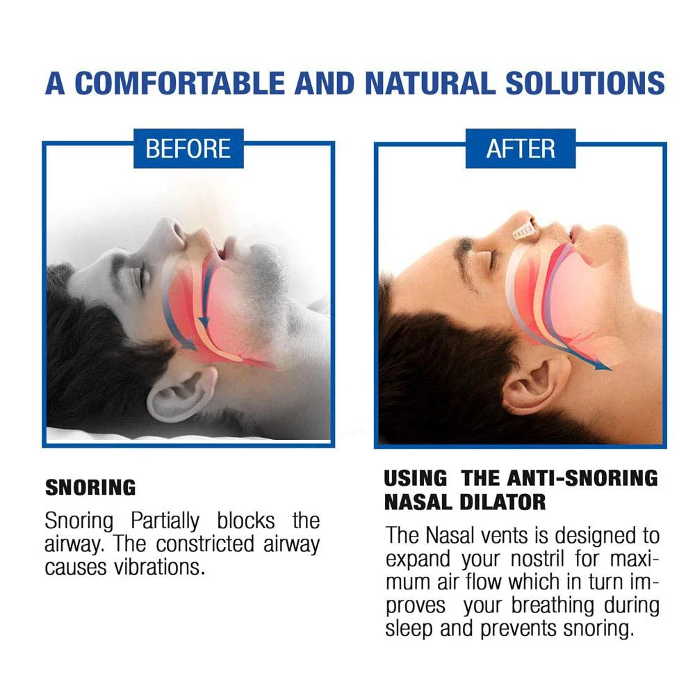 2 коробки = 8 шт. анти храп против храпа апноэ зажим для носа дыхательный аппарат