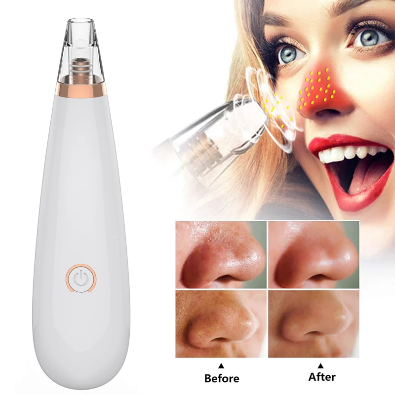 Инструмент для удаления чёрных точек вакуумный аппарат очистки пор акне