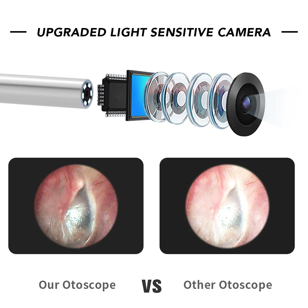 TESLONG 3 в 1 ухо эндоскоп Камера 4 мм инструмент для чистки ушей визуальная ухочистка
