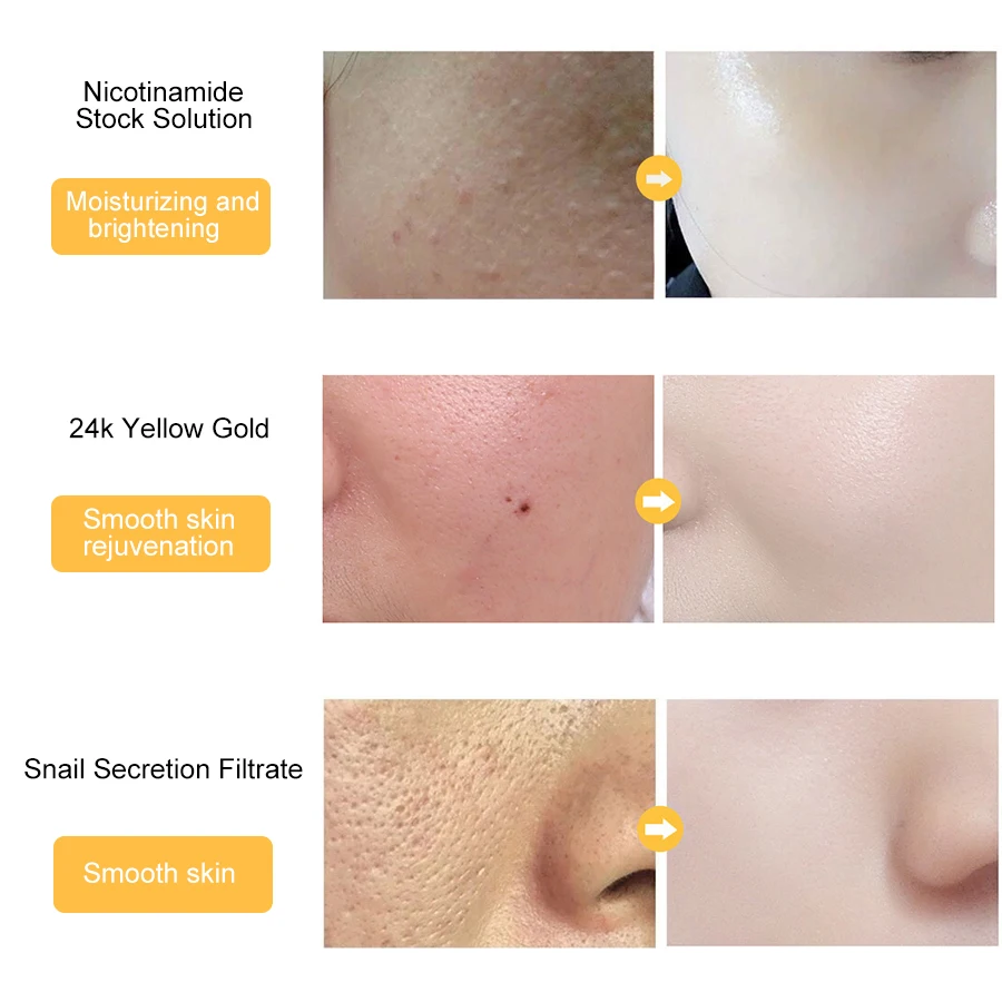 24K Gold Niacinamide Face Essence Anti-aging&ampWrinkle Injectable Hyaluronic Acid Serum Shrinks Pores Repairs Dry Loose Skin care |