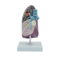 pathological lung anatomy model of human smoker medical science teaching resources drop shipping