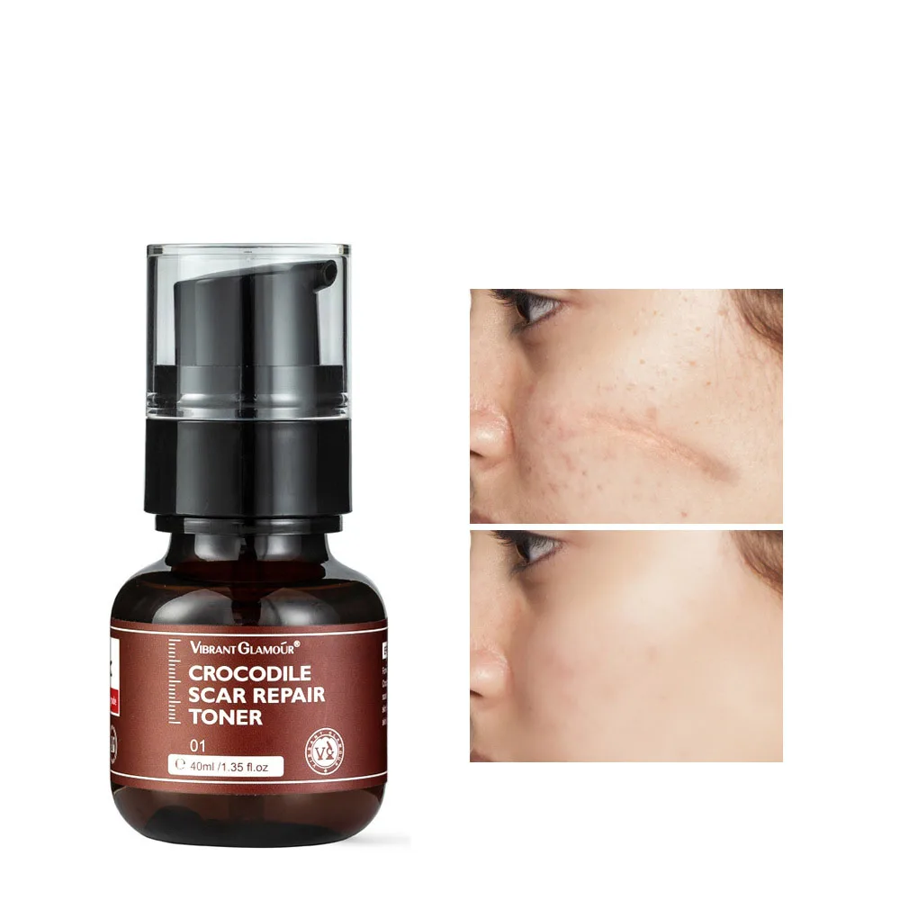 Centella Asiatica Anti-inflammatory Repairing Liquid Helps Decompose Melanin Promote Collagen Regeneration Fade Scars Face Serum |
