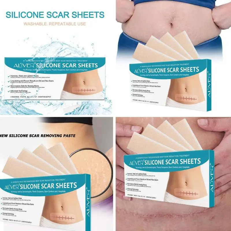 Safe Scar Removal Sticker Acne Non-toxic Skin-friendly Practical Therapy Delicate Design Long-lasting Plaster Set | Красота и