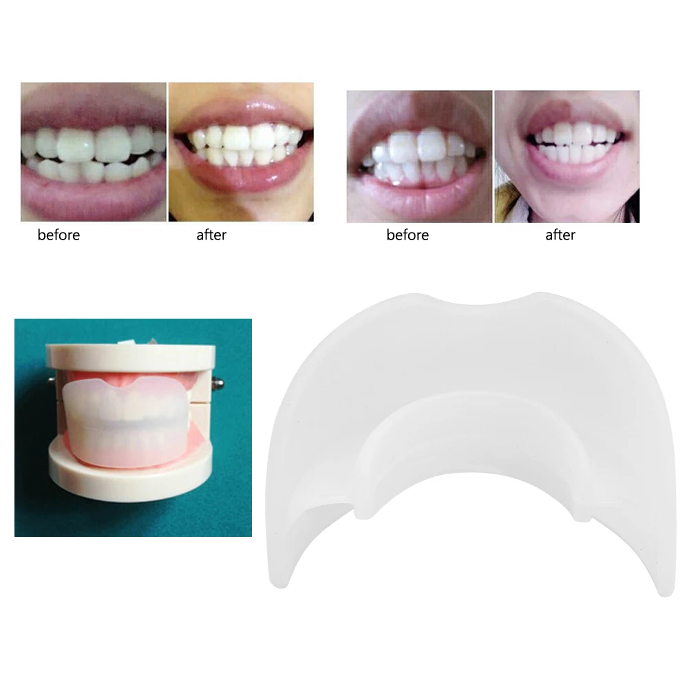 

Portable Food Grade Silicone Flexible Dental Orthodontic Anti Grinding Teeth Brace Double Layer Guard Tooth Retainer Corrector
