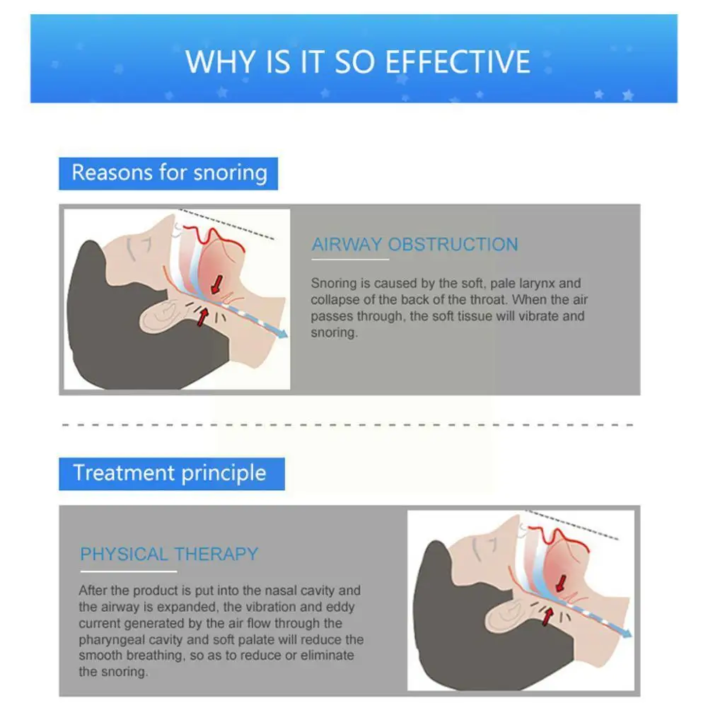 

Силиконовый магнитный зажим для носа для предотвращения храпа, устройство для защиты от апноэ, оборудование для предотвращения храпа, F6t4