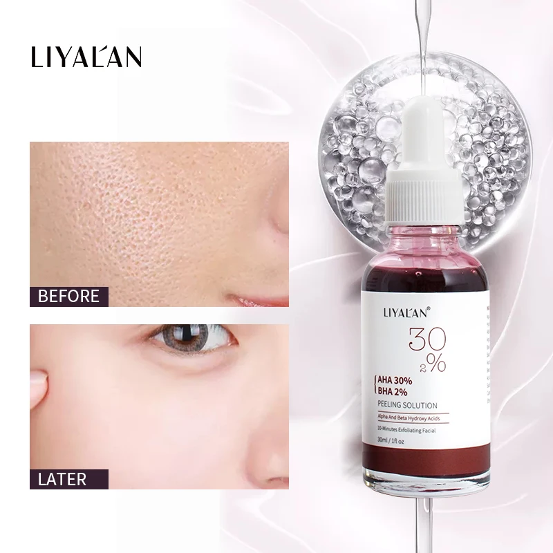 

AHA 30% BHA 2% Peeling Solution Exfoliator Anti-Acne Repair Scars Facial Essence Face Liquid Serum 30ml