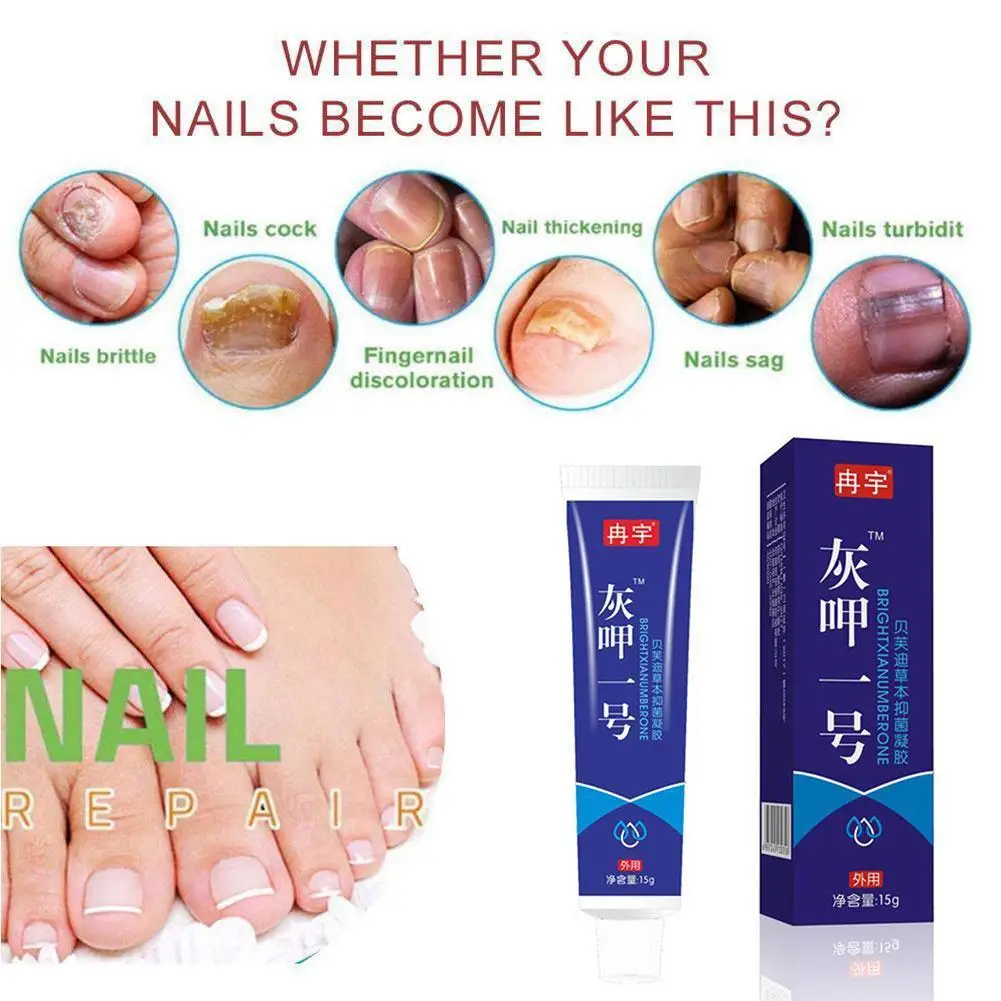 

1Pcs Antibacterial Chinese Natural Herbal Cream Nail Anti Fungus Cream Onychomycosis Gel Toes Infection Repair Cream Toes N D3P3