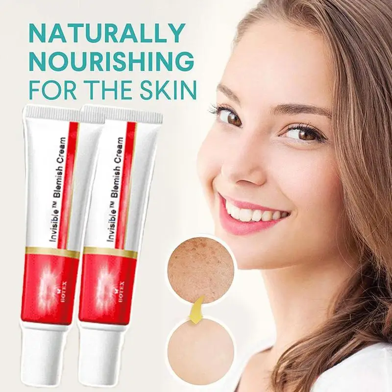 Whitening Freckle Cream Removal Melasma Acne Scar Pigment Melanin Sun Spots Face Care