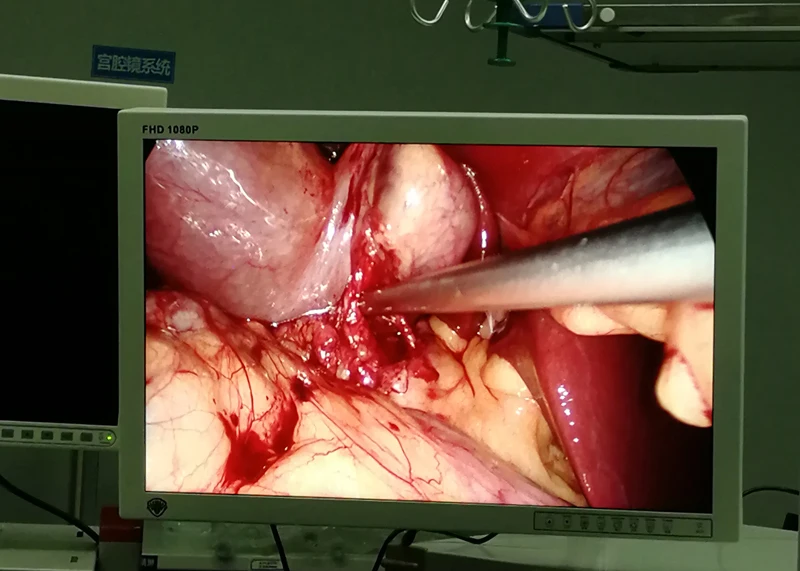 НОВАЯ переносная эндоскоп-камера голова водонепроницаемое оборудование 1080P