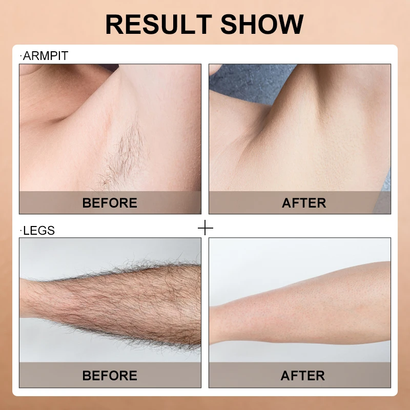 

999999 Flashes 2020 New Laser Epilator Permanent IPL Photoepilator Hair Removal Photo Women Painless electric Epilator Machine