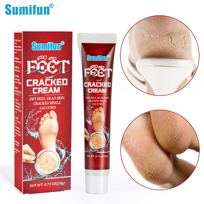 

20g Sumifun Chapped Moisturize Cream For Cracked Heel Skin Anti Dry Peeling Callus Dead Skin Removal Chinese Medical Ointment