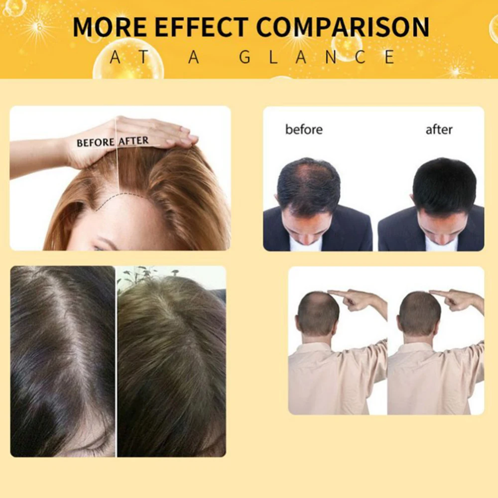 Сыворотка от выпадения волос уход за выпадением Эфирные ОИ жидкость для