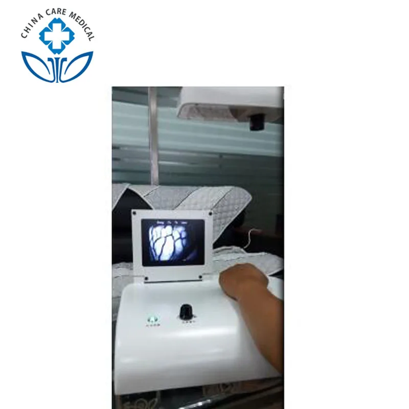 

Smart Vein Finder Cost For Nurses