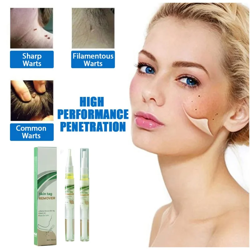 2 шт. бактериостатическая жидкость для удаления бородавок на ногах | Красота и