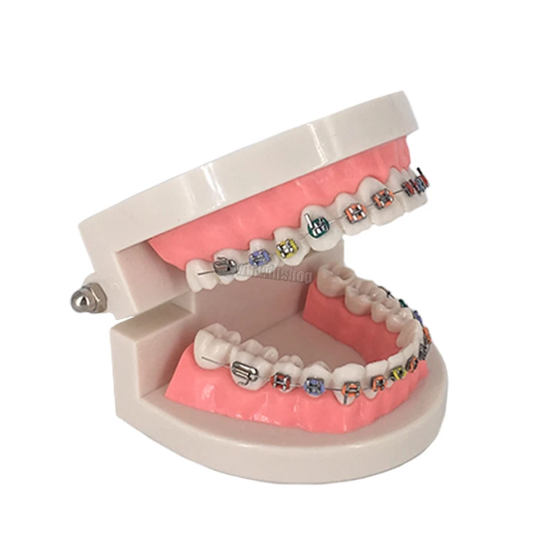 1 шт. Стоматологическая Ортодонтическая модель для лечения зубов с Орто