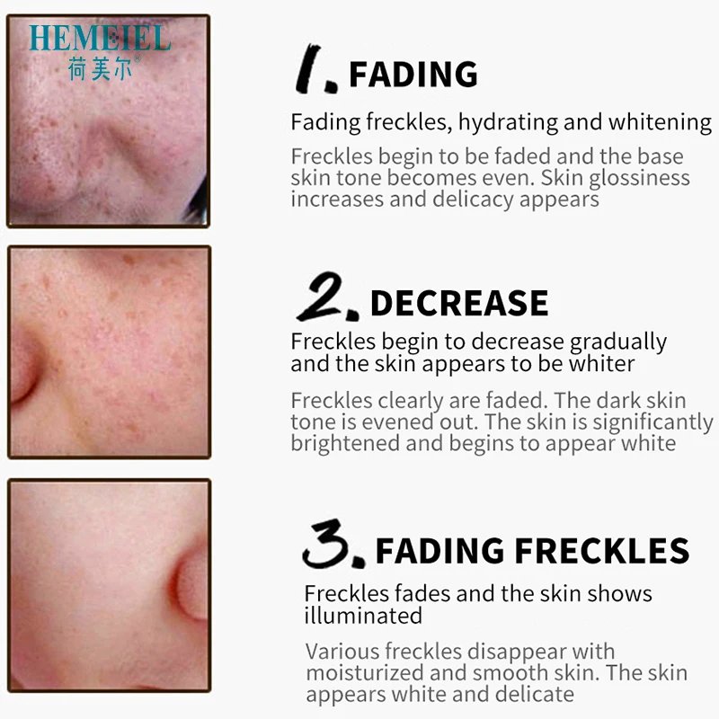 HEMEIEL сильно отбеливающий крем для лица от черных точек корректор удаления