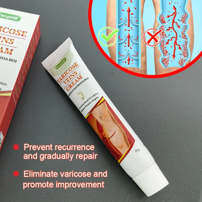 

1pcs New Arrivals Genitals Varicosity Cream Scrotum Varicocele Medical Ointment Leg Varicose Veins Potent Treatment Cream G002